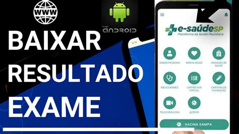 optixone exames|retire seu exame sus.